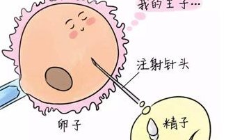 广州去做三代试管？广州第三代试管机构