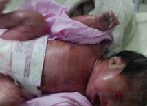 高龄女性可以做试管婴儿吗？