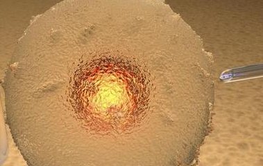 三代试管婴儿有畸形的风险吗？